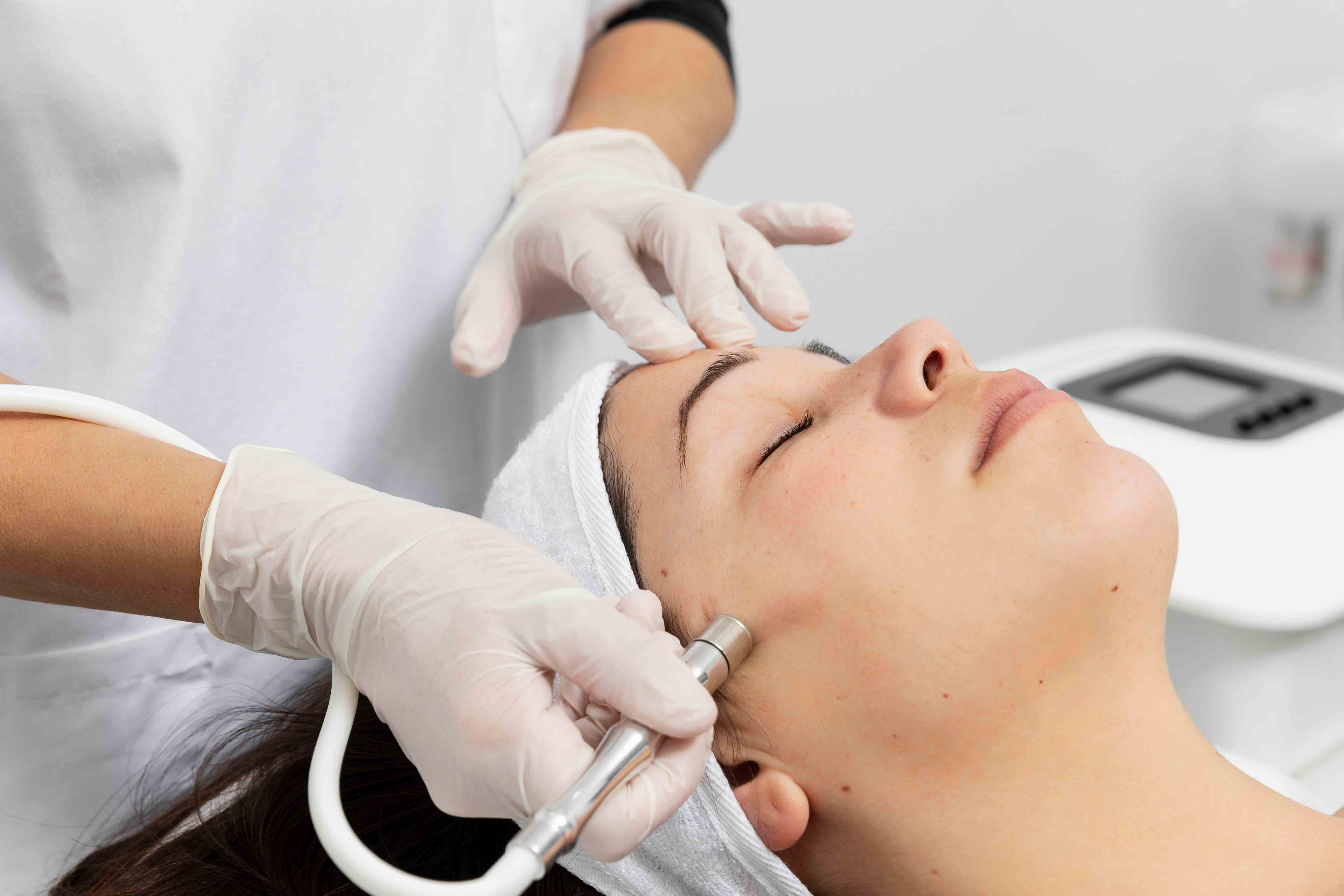 Microdermabrasion